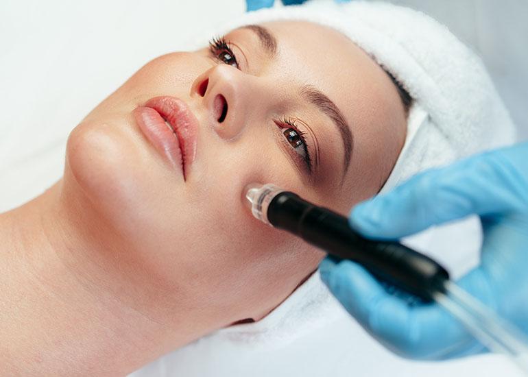 microdermabrasion facial treatment at Mimi's Laser Alternatives